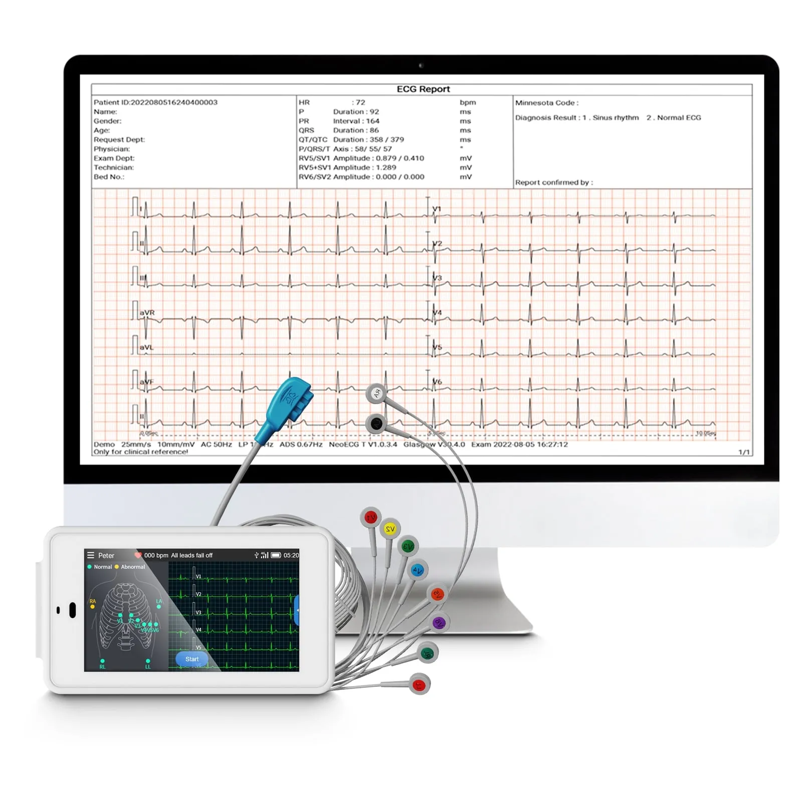 12-Lead Pocket ECG Machine