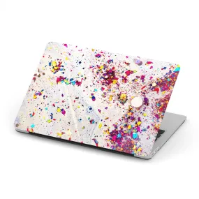 Macbook Hard Shell Case - Candy Chips